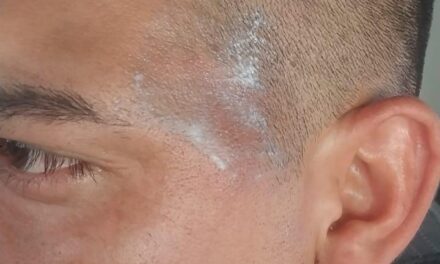 Quemaron con agua hirviendo a un policía en un operativo